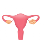 Home pcos